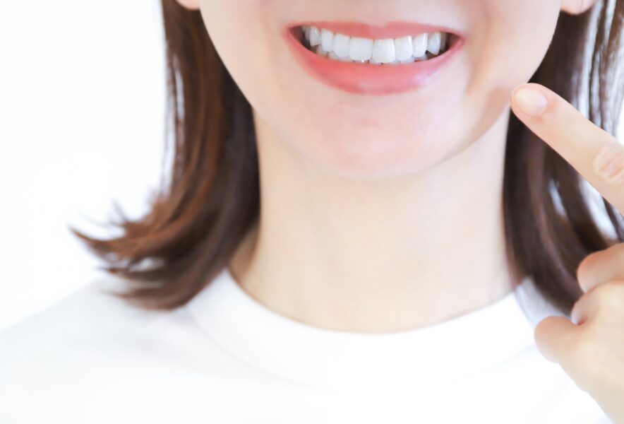 白い歯　歯並びイメージ