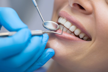 入れ歯使用者が歯周病を予防するためにできること