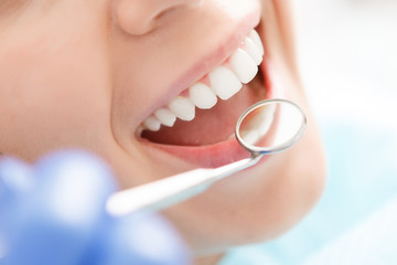 歯周病のセルフケアに適した歯ブラシのポイント