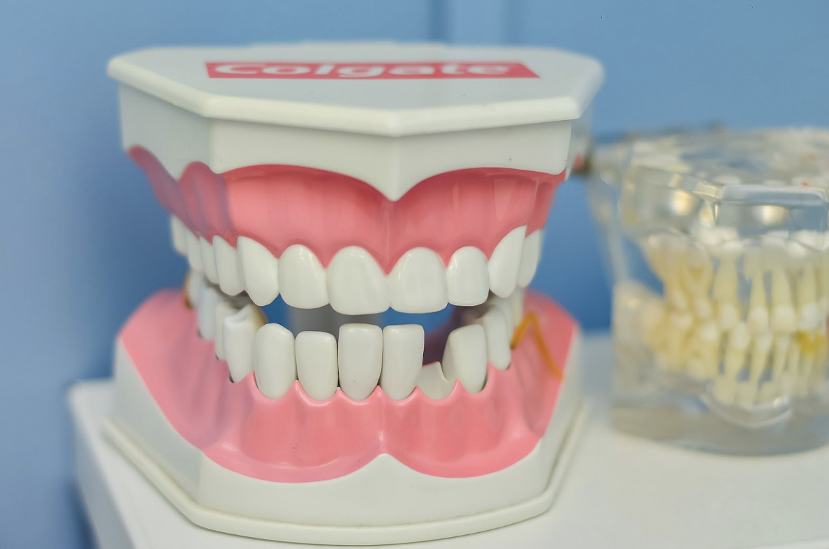 歯周病と出血の関係