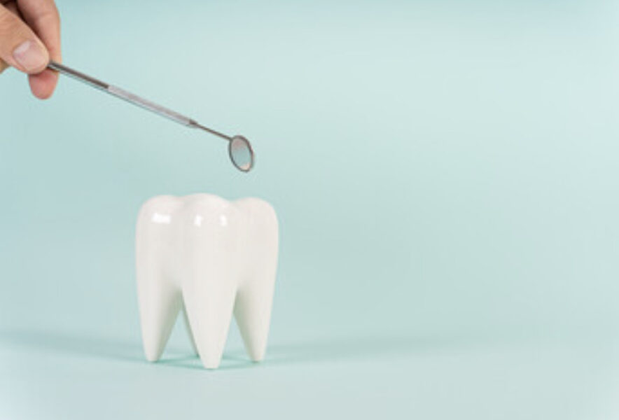 歯周病かどうかはどうやって判断する？