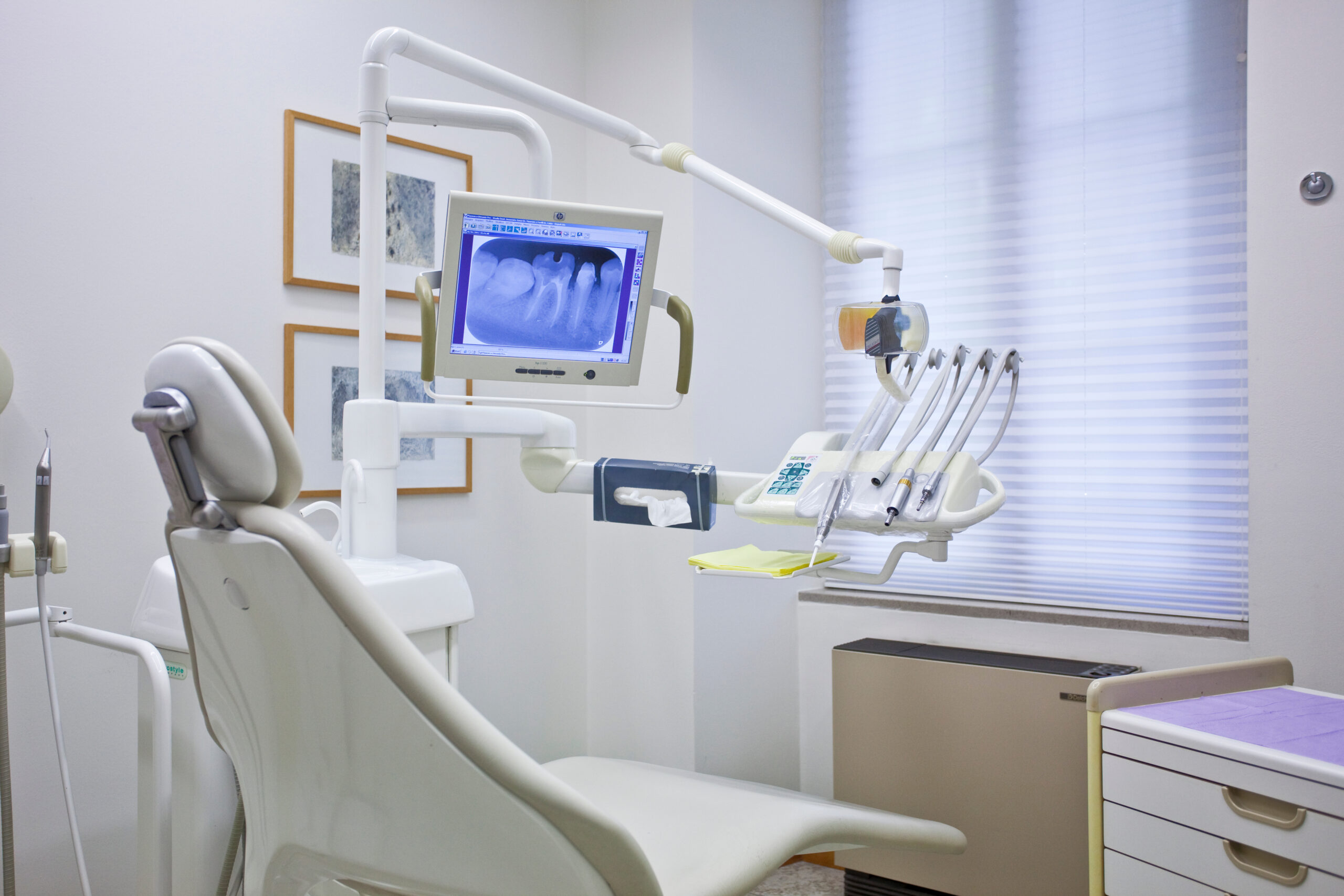 歯周病菌の内定期検診の頻度
