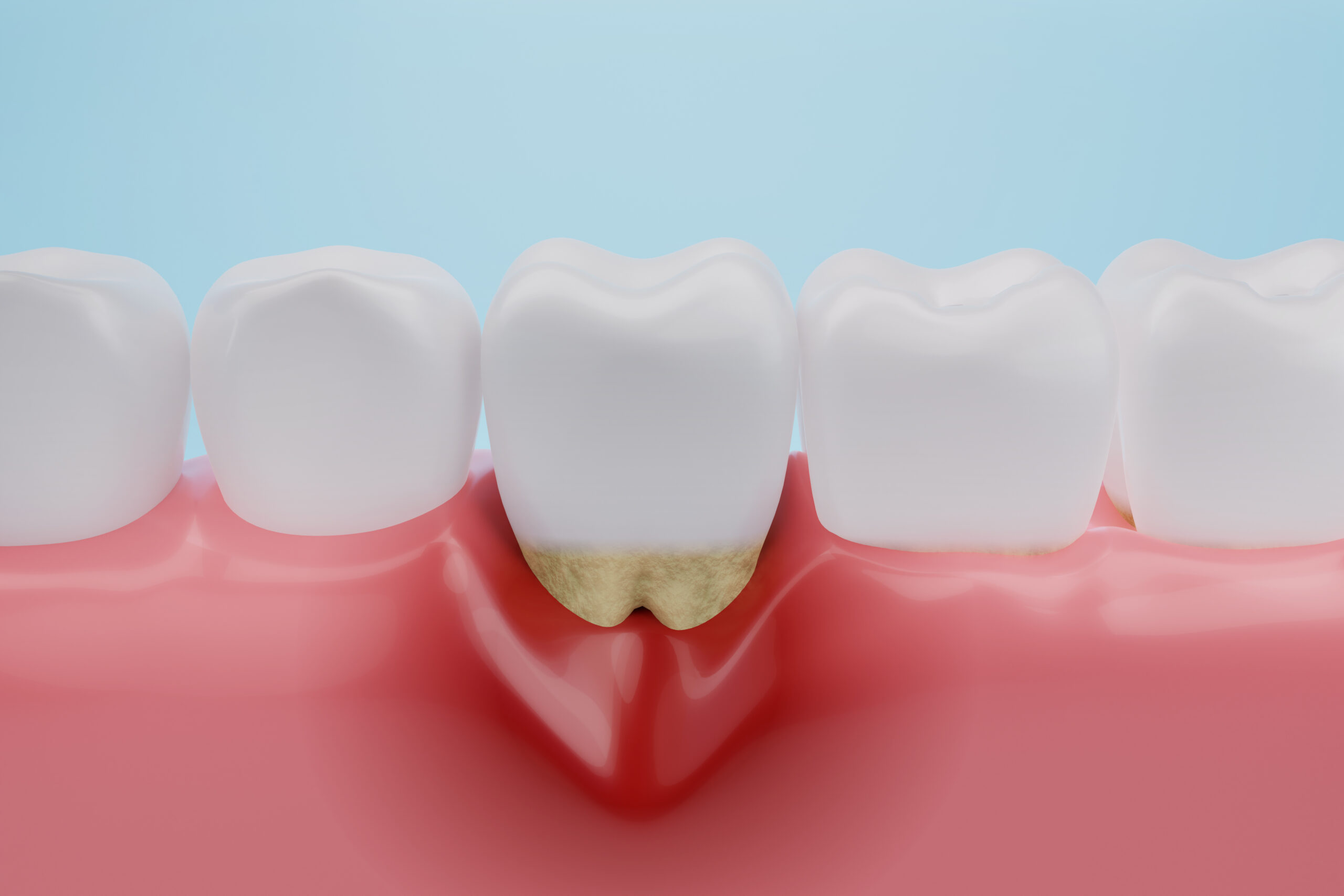 歯周病の危険性