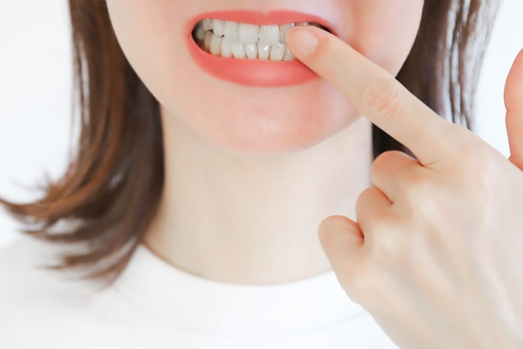 歯槽膿漏の特徴と原因